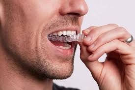 Clear Aligners In Tolichowki