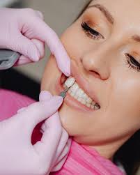 Cosmetic Dental Clinic Hyderabad