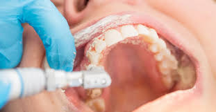 Dentist In Shamshabad