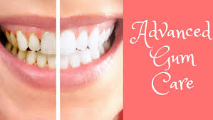 Gum Care Dentist Attapur