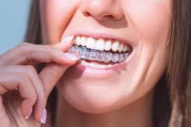 Invisalign Treatment Near Me