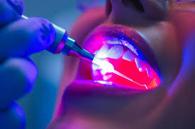 Laser Dentistry Near Me