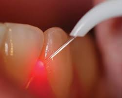 Laser dental clinic