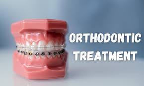 Orthodontic Clinic In Bandlaguda