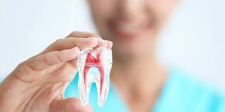 Rct Dentist In Mehdipatnam
