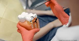 Rct Dentist In Shamshabad