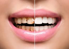 Gums Treatment Near Me