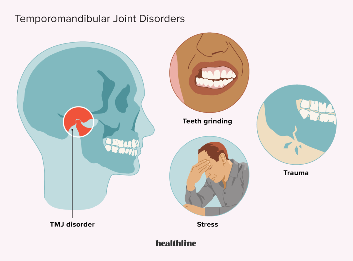 Tmj Pain Relief Treatment