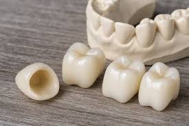 Zirconia Caps In Tolichowki